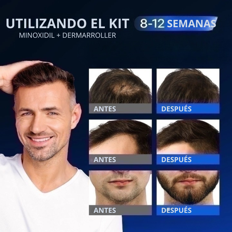KIT CRECE YA: MINOXIDIL 5% + DERMARROLLER 0,5 mm